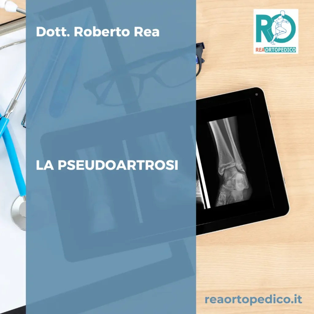 LA PSEUDOARTROSI