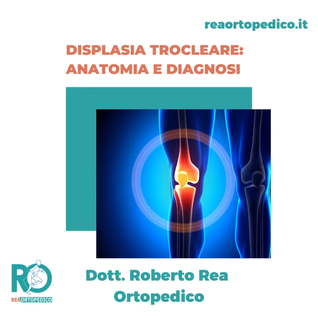 Displasia Trocleare