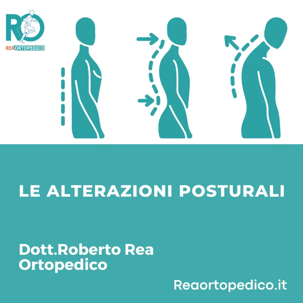 Le alterazioni posturali