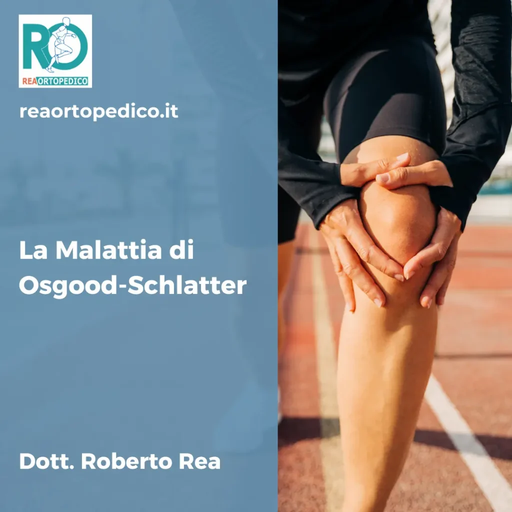 La malattia di Osgood-Schlatter